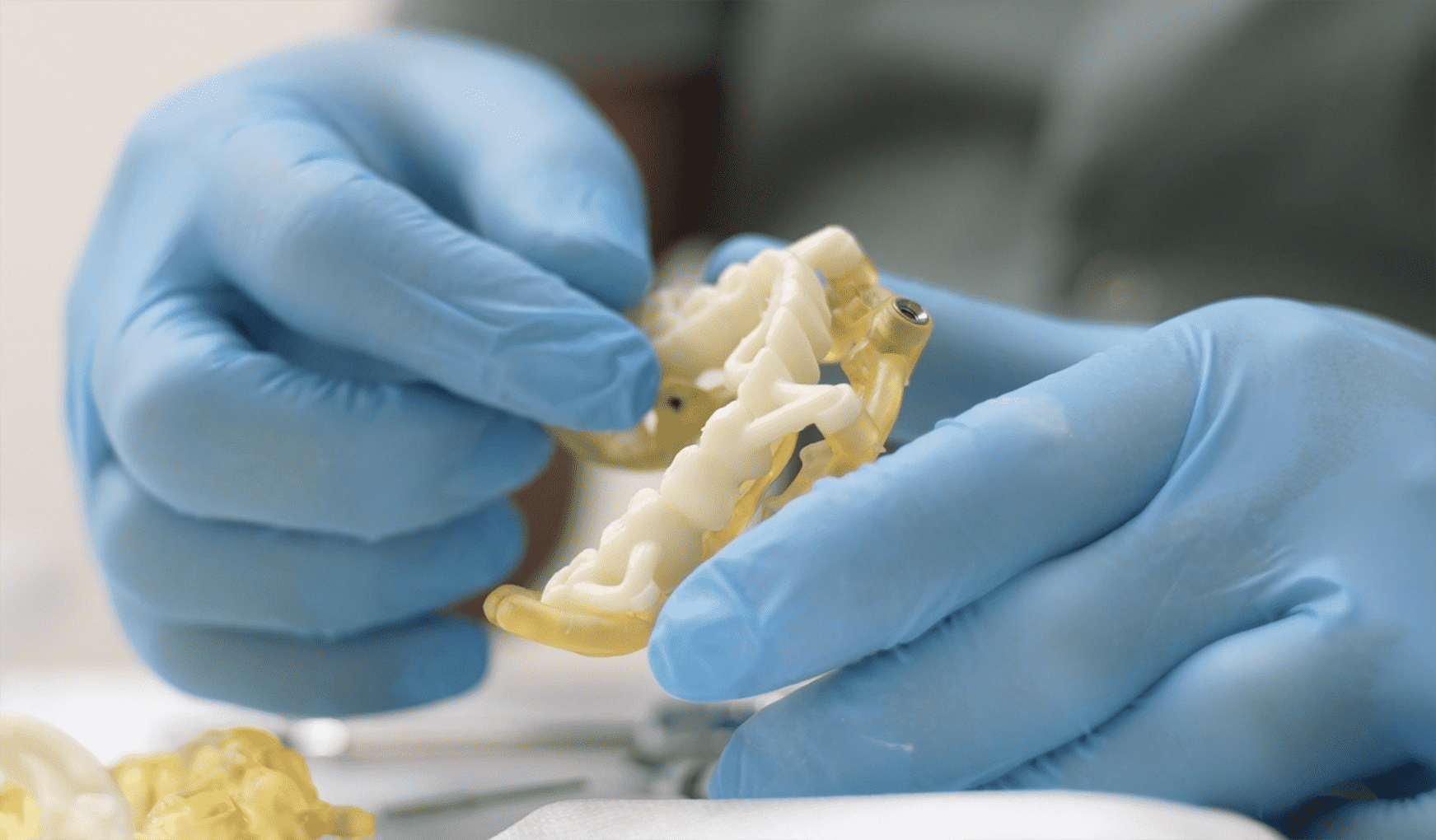 Навигационная имплантация