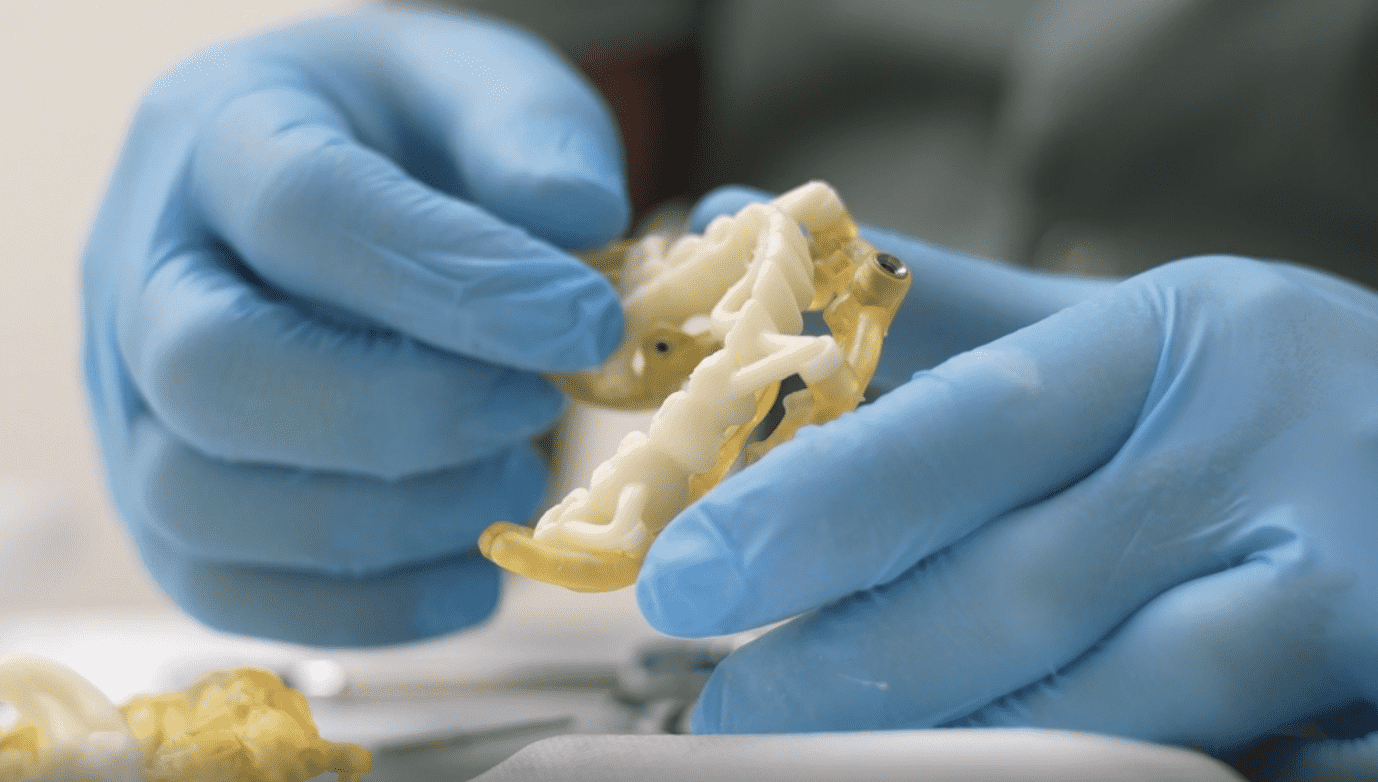 Имплантация по шаблону