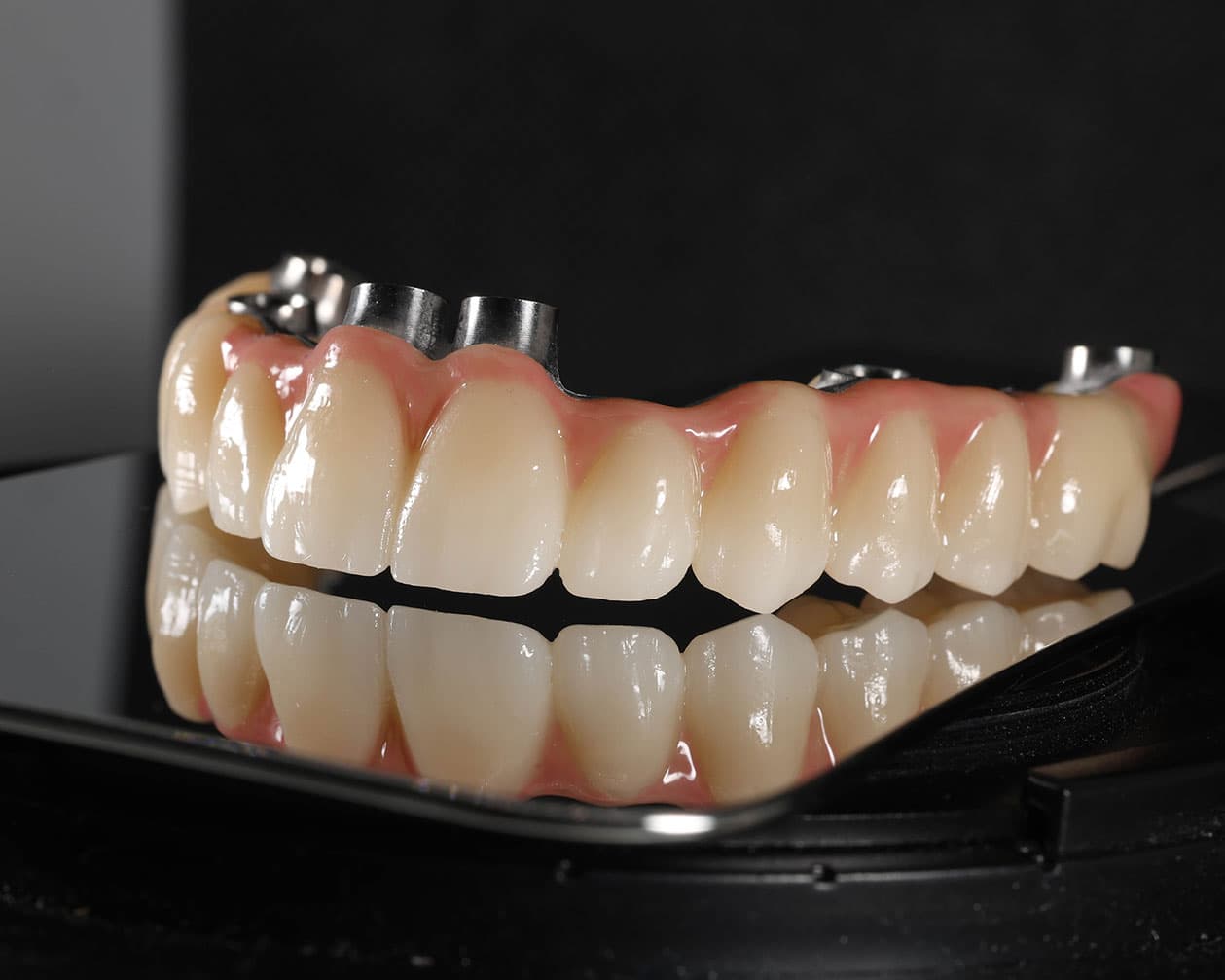  Имплантация All-On-6